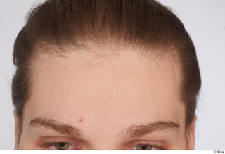 Arvid forehead head 0001.jpg